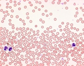 Hemacolor® Rapid staining of blood smear staining set for microscopy