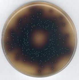 Bile Aesculin Azide Agar, acc. to ISO 7899-2 for microbiology