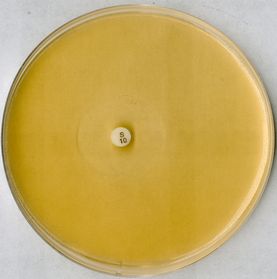 Antibiotic agar no. 11 GROVE and RANDALL medium no. 11 for microbiology