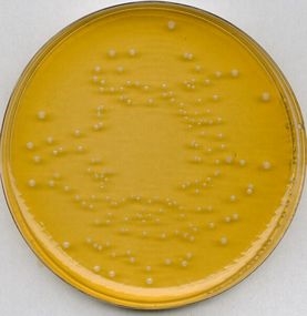Universal beer agar for microbiology