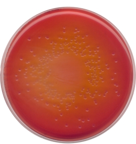 MacCONKEY agar for the isolation of Salmonella, Shigella and coliform bacteria (According harm.