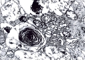 Glutardialdehyde solution 25% for electron microscopy, acc. to P.J. Anderson (purified and fill