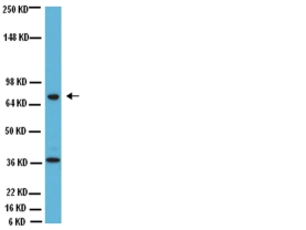 Anti-Choline Acetyltransferase Antibody