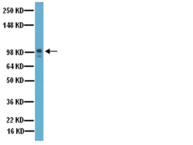 Anti-MMP-9 Antibody, Catalytic domain
