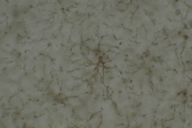 Anti-NG2 Chondroitin Sulfate Proteoglycan Antibody