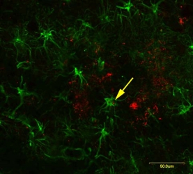 Anti-Amyloid Oligomer Antibody, αβ, oligomeric