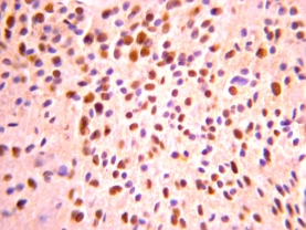Anti-Olig-2 Antibody