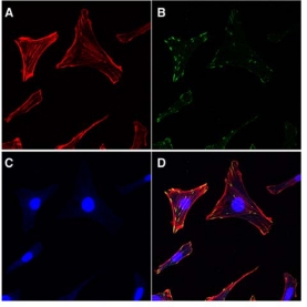 Actin Cytoskeleton / Focal Adhesion Staining Kit