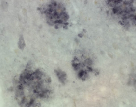 Anti-Presenilin-1 Antibody, NT, clone hPS1-NT