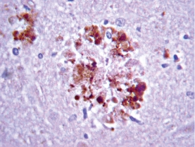 Anti-APP A4 Antibody, a.a. 66-81 of APP {NT}, clone 22C11