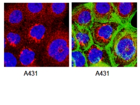 Anti-Presenilin-1 Antibody, loop, a.a. 263-378, CT, clone PS1-loop