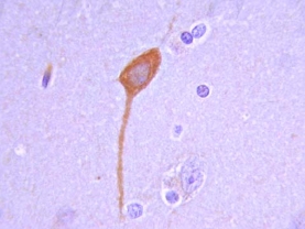Anti-GAD67 Antibody, clone 1G10.2