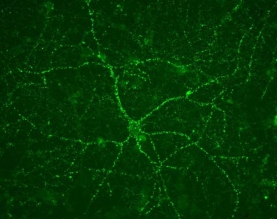 Anti-Vesicular Glutamate Transporter 1 Antibody