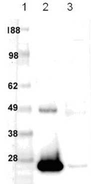 Anti-Bcl-2 (Ab-2) Rabbit pAb
