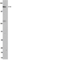 A-ROKA/ROCK-II,  CLONE A9W4  100ul