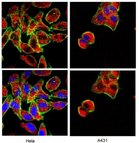 A HU  BAK, NT,RAB PC 12-301