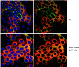 Anti-phospho-Ribosomal Protein S6 (