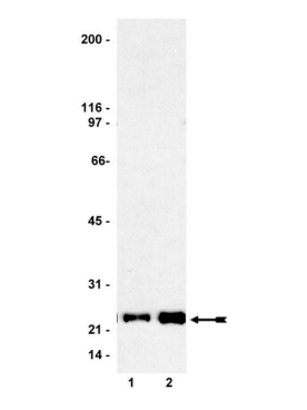 RAS  ACTIVATION ASSAY KIT