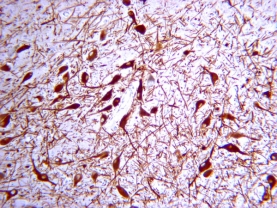 TYROSINE HYDROXYLASE, RB X-100UL