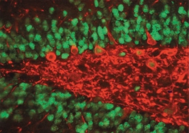 NEURONAL SPEC NUC PROT, MS X-500UG