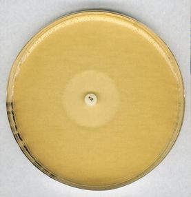 Antibiotic agar no. 11 GROVE and RANDALL medium no. 11 for microbiology