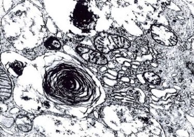 Osmic acid solution 2% for electron microscopy