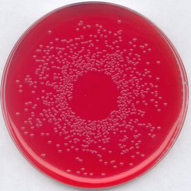 BPLS agar modified Brilliant-green phenol-red lactose sucrose agar modified, for microbiology