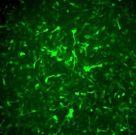 Alzheimer’s In A Dish™ APPSL-GFP Lentivirus