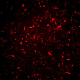 Alzheimer’s In A Dish™ PSEN1-RFP Lentivirus