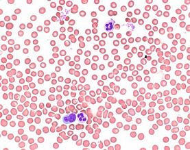 Wright's eosin methylene blue solution for microscopy