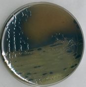 Bismuth sulfite agar acc. to WILSON-BLAIR for the isolation and differentiation of Salmonella t