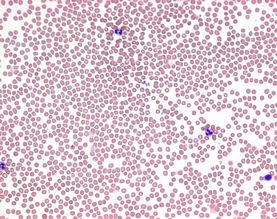 Wright's eosine methylene blue for microscopy