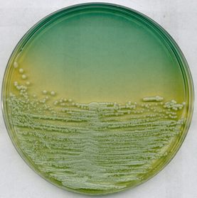 WL nutrient agar for microbiology