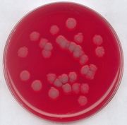 Blood agar (base) for the isolation and cultivation of various fastidious microorganisms