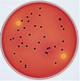 XLT4 agar (Base) for microbiology