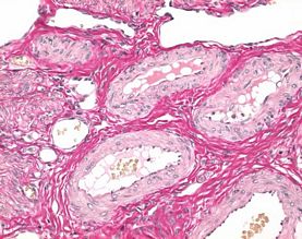 Weigert's iron hematoxylin kit for nuclear staining in histology