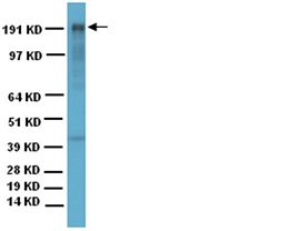 Anti-MAP2 Antibody, clone AP20