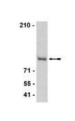 Anti-CTCF (rabbit antiserum)