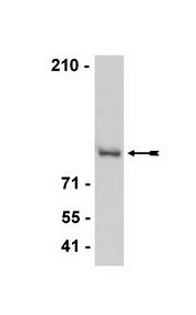 Anti-CTCF (rabbit antiserum)