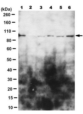 Anti-MCAM/CD146