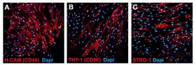 Human mesenchymal stem cells (bone