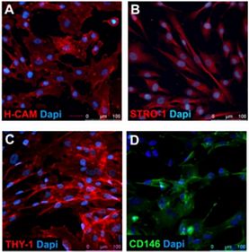 Human Mesenchymal Stem Cells (hESC