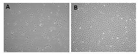 Human Adipose Mesenchymal Stem Cells