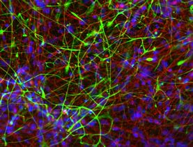 HumanES/iPS Neuronal Differentiation Med